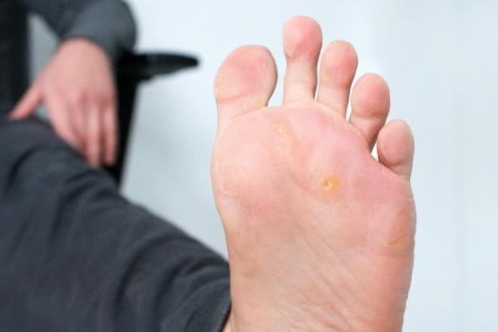 cors pieds 