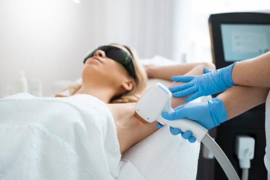 épilation laser épilation laser