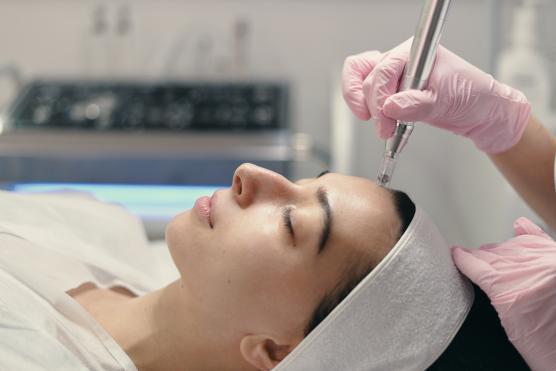 microneedling microneedling